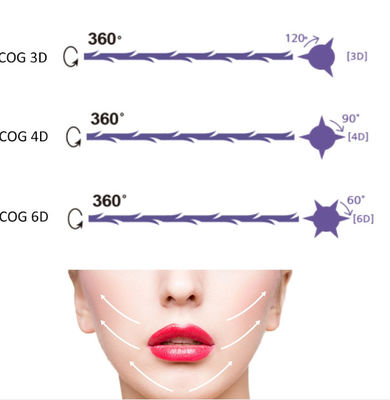 PDO Pcl Nose Thread Lift العناية بالبشرة شد الخيوط علاج الجلد