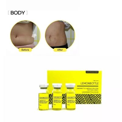 بيع زجاجة ليمون محلول الدهون 5X10ml مربع حل فقدان الوزن على الانترنت