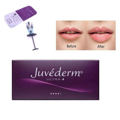 الحامض الجلدي لـ Allergan Juvederm Ultra4 مع Lido