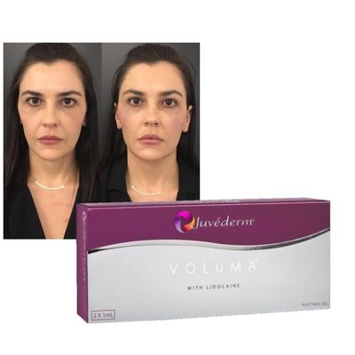 الحمض الهيالوروني المرتبط بالعبرة الحامض الجلدي Juvederm Ultra 3 4 و Voluma بيع بالجملة