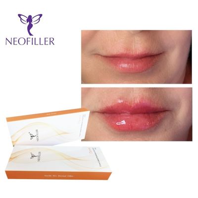 24mg-ml 2ml المحقنة الجلدية حمض الهيالورونيك الحامض الجلدي المحقق جيل تجديد الوجه