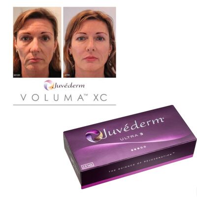 تصحيح التجاعيد Juvederm الحامض الجلوي الحمض الهيالوروني المحقن العلاج الملسط طويل الأمد
