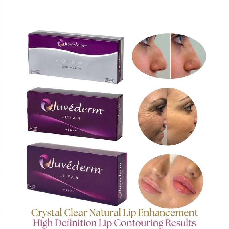 حجم المحقنة 2 1 مل لكل علبة Juvederm Voluma Filler Safety Face Contouring Injectable Dermal Filler لزيادة الحجم