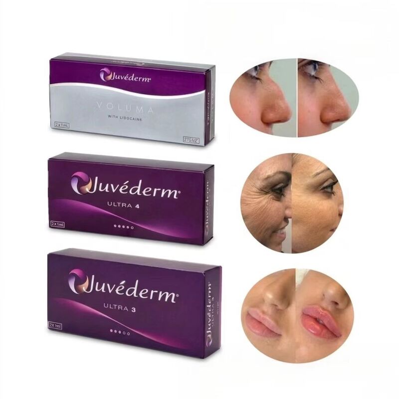 24mg/ ml Juvederm ملء الشفاه Juvederm Ultra3 Ultra4 Voluma الحقن